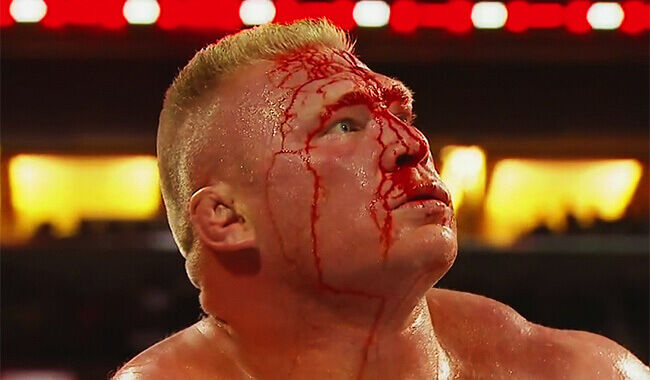 A battered Lesnar is not &quot;best for business&quot;