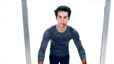 Dylan O’Brien’s Injuries “Not as Severe” as First Reported