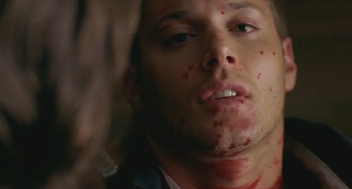 Dean dead and bloody