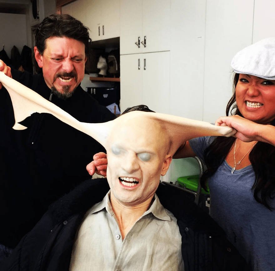 Everyman prosthetics coming off