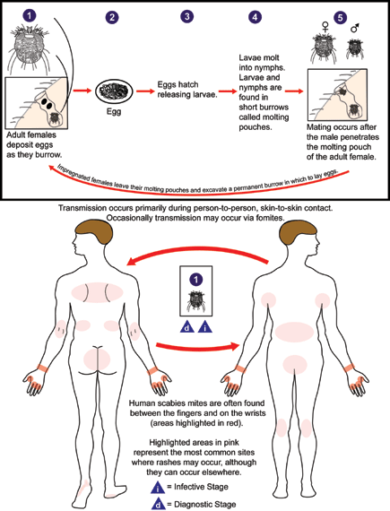 Scabies LifeCycle