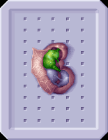 Celatid Autopsy