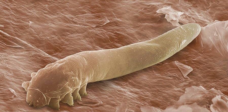 Health: This mite lives in the pores of the skin and feeds on makeup!