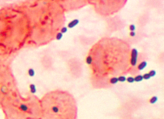 240px-Enterococcus histological pneumonia 01-1-