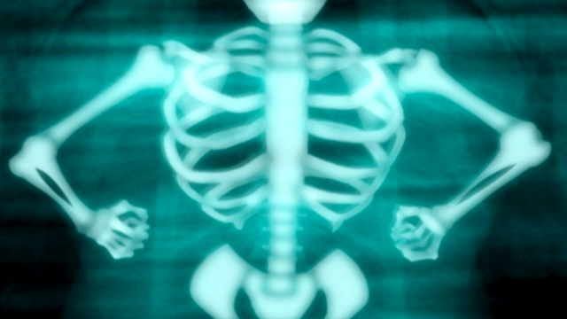 File:ATG (316).png