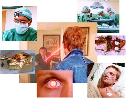 Bionic operation Michael