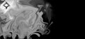 Thumbnail for version as of 13:45, August 17, 2011
