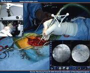 Imageguidedsurgery
