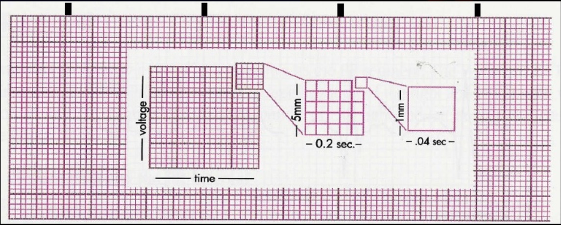 electrocardiographs bmet wiki fandom powered by wikia ecg graph paper scale