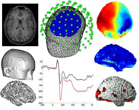 electroencephalography bmet wiki fandom powered by wikia electroencephalography