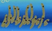 180px-Nematodes 1