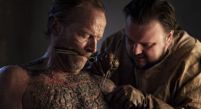 Sam Tarley and Jorah Mormont perform grayscale surgery