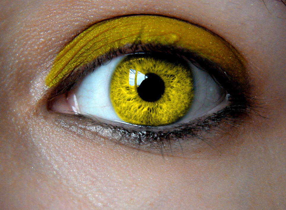 blue eyes yellow around pupil blue eyes yellow around pupil