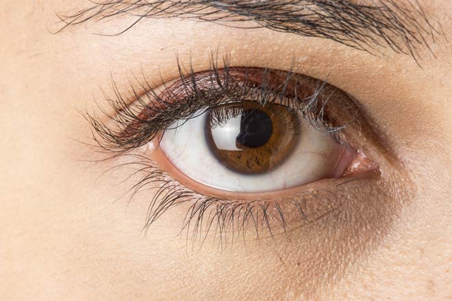 brown eyes