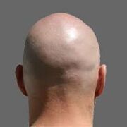 Bald
