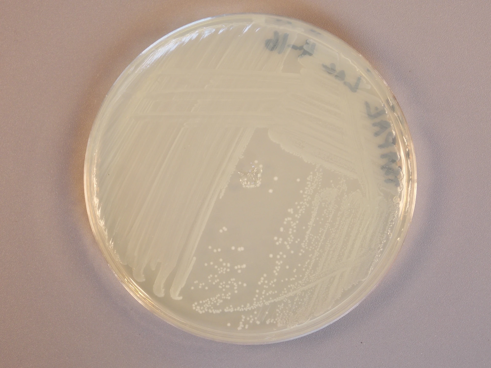 Image - Lactobacillus acidophilus.JPG | Classroom Bacterial ...