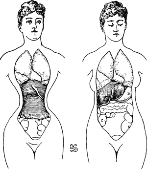 Squishy-guts-from-corsets