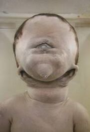 Deformed-child