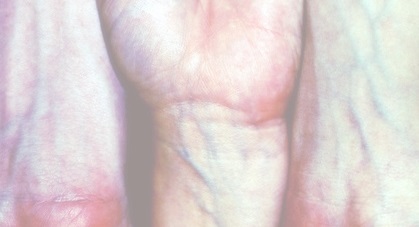 Veins