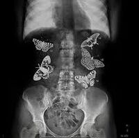Butterflies In Your Stomach Creepypasta Wiki Fandom