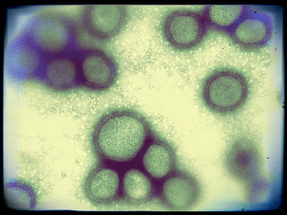 Erreger1