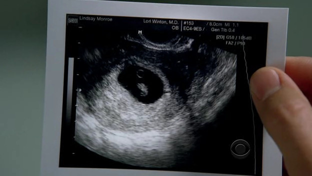 image sonogram of lucy lucy messer 7862581 624 352 jpg csi