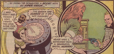 Vartox time scanscope