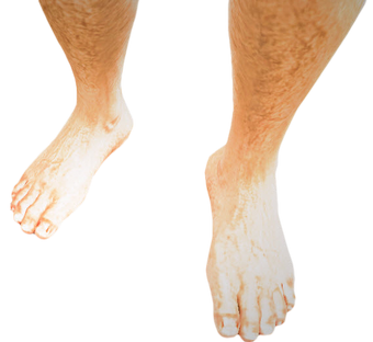 Bare Feet Dead Rising 2 Dead Rising Wiki Fandom
