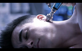 Thecureprocedure