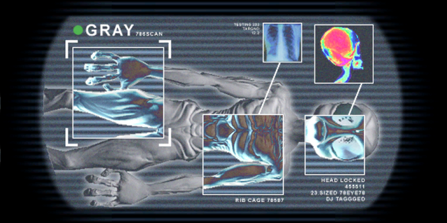 File:Gray scan.png