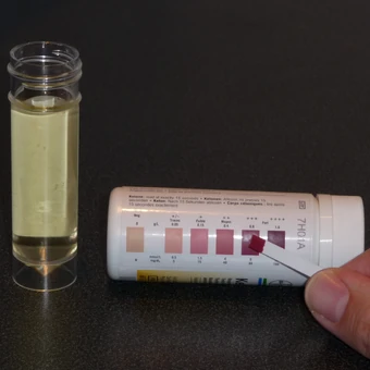 dog diabetes urine test strips