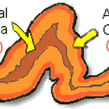 Adrenal fatigue cushings syndrome