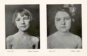 Eugenia-corwin