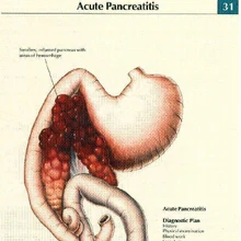 best diet for pancreatitis in dogs