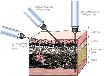 subcutaneous fluids dog kidney failure