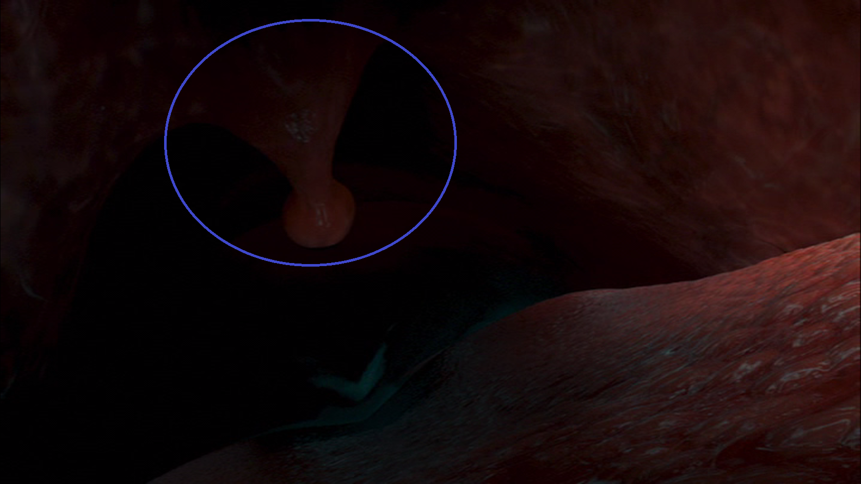 Image - Nemo whale uvula circled.png | Disney Wiki ...