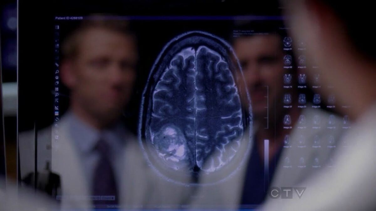 grey's anatomy brain scan