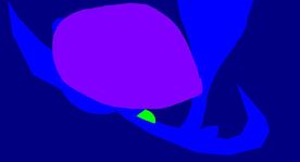 Martian fetus