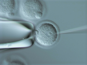 Transgenesis