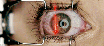 DAÑO OCULAR