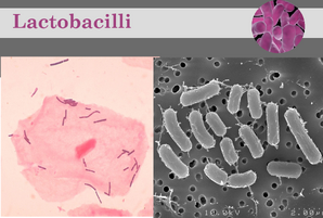 Lactobacilli