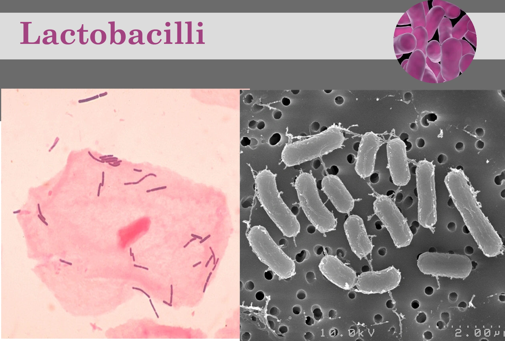 Lactobacillus Wiki FANDOM powered by Wikia