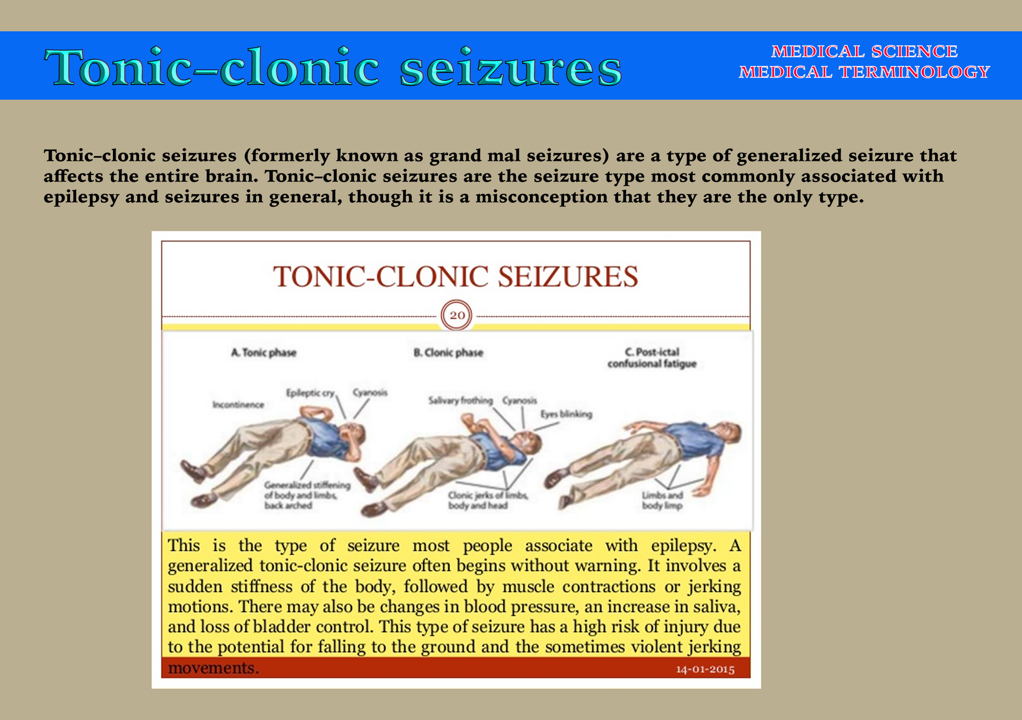 tonic-clonic-seizures-galnet-wiki-fandom