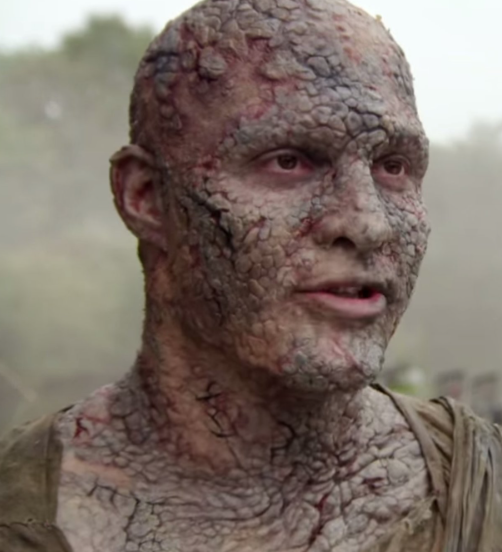 Maladie De L'homme De Pierre Photos Hommes de pierre | Wiki Game of Thrones | FANDOM powered by Wikia