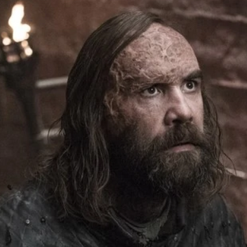 Sandor Clegane Game Of Thrones Wiki Fandom