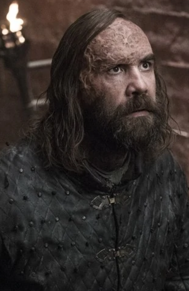 Sandor Clegane Game Of Thrones Wiki Fandom