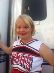 Glee Down Syndrome