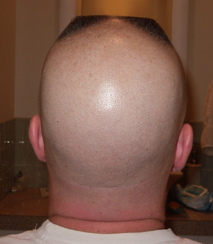 Horseshoe Flattop Haircut Video what hairstyle is best for me