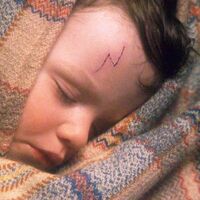 Harry Potter S Scars Harry Potter Wiki Fandom