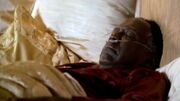 Charles in a coma